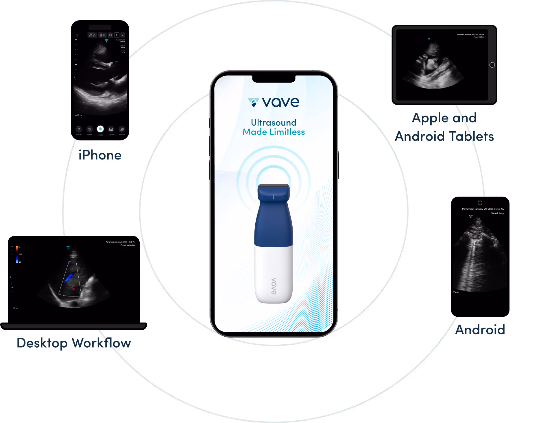 Vave Universal Probe – iPhone, טאבלטים ומחשב