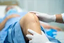 asian-senior-woman-patient-show-her-scars-surgical-total-knee-joint-replacement.webp