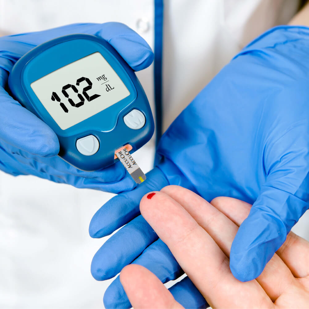 סטיקים למד סוכר (גלוקומטר) דגם Accu-Chek Performa סטיקים - image_5