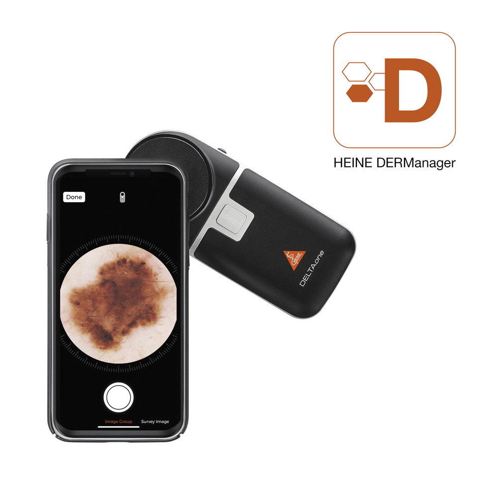 דרמטוסקופ HEINE DELTAone שחור + לבן - image_4