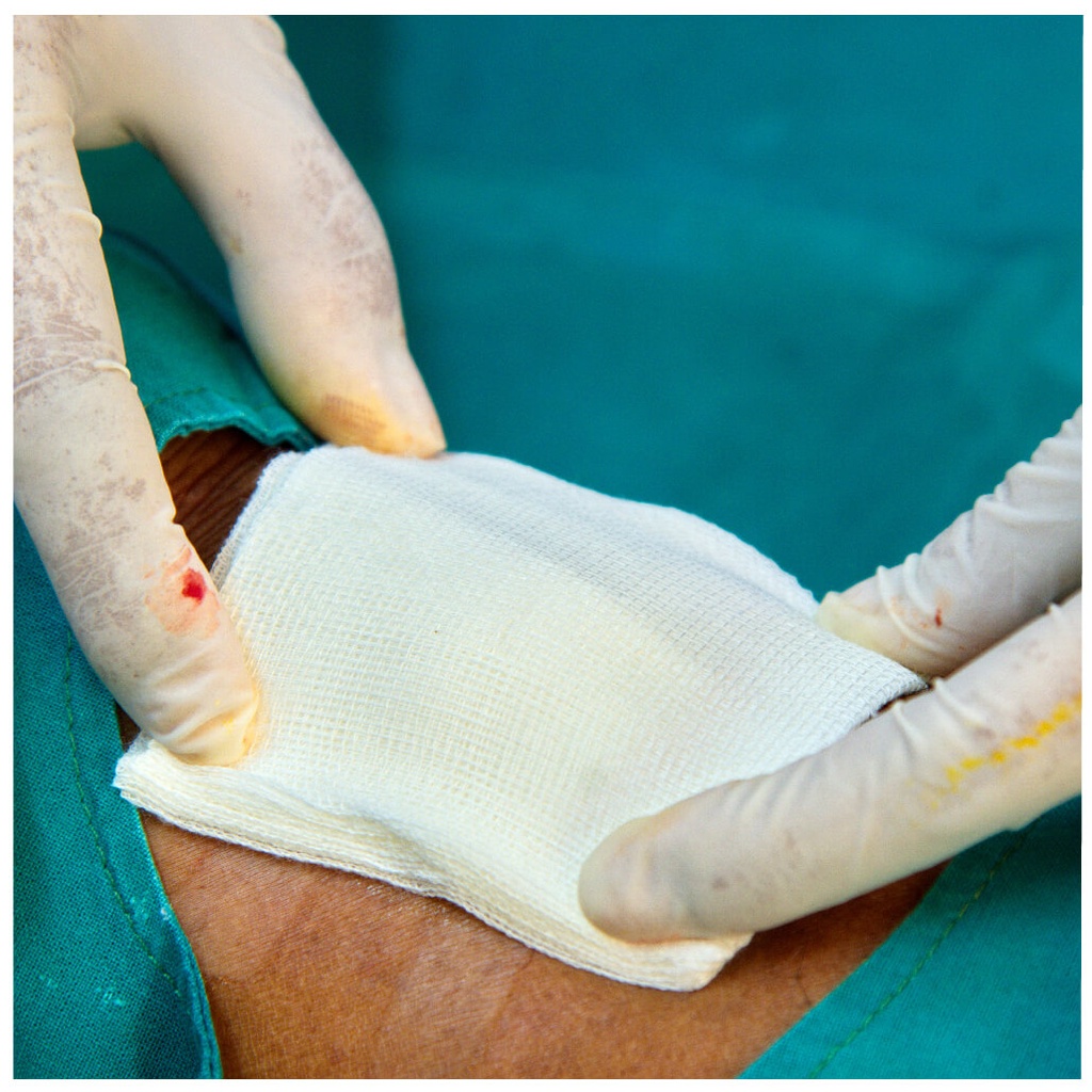 פד גזה סטרילי 10 ס"מ 100 יח ס.מדיק יבוא - image_4