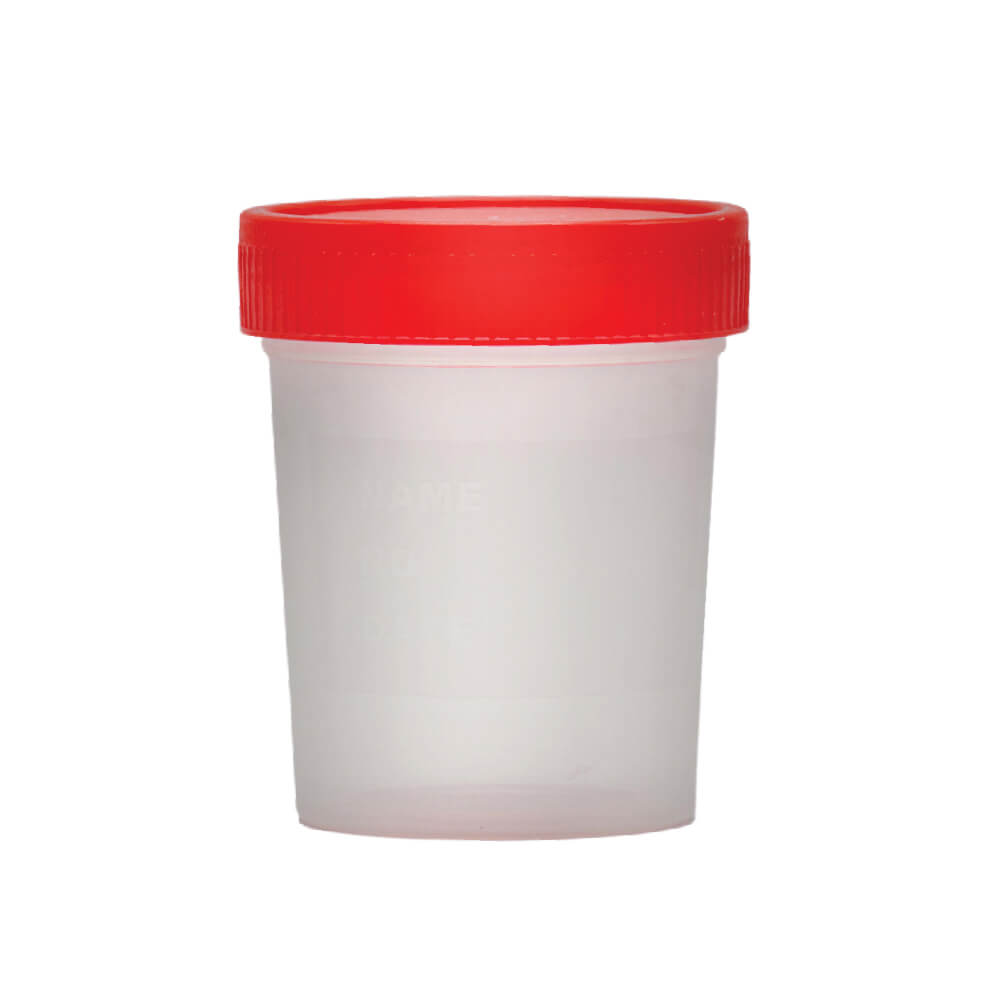 [462002] כוס איסוף שתן עם מכסה. Urine Specimen Cup with Lid. סטרילית, 5 יחידות. ס.מדיק יבוא