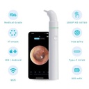 אוטוסקופ חכם לבית. Smart Digital Otoscope. חיבור Wi-Fi/Bluetooth. אפליקציה לטלרפואה. בדיקת אוזניים לכל המשפחה. ס.מדיק יבוא